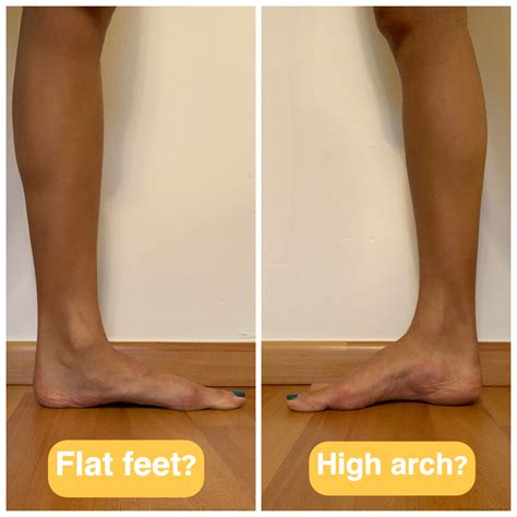 Flat Feet And High Arches What Do They Mean
