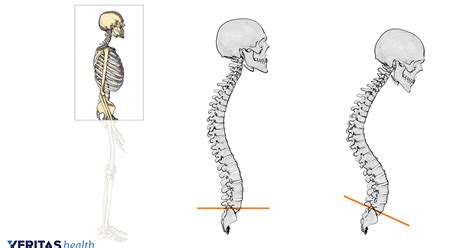 Posture To Straighten Your Back