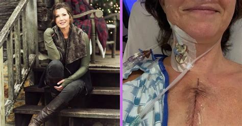 amy grant shares recovery photos following open heart surgery