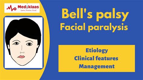 Bells Palsy Facial Palsy L Neuroscience L General Surgery L Mediklaas Youtube