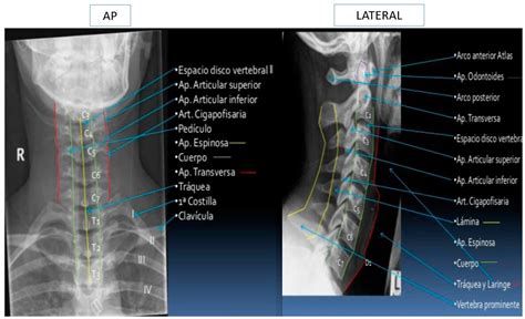 Anatom A De La Columna Cervical Dolopedia
