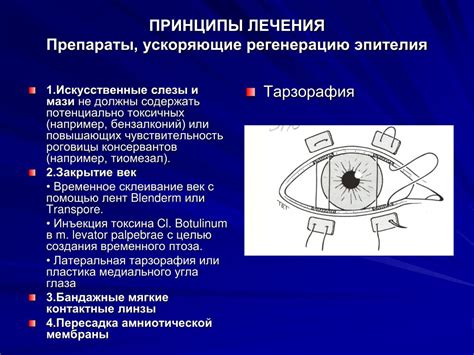 PPT - КЕРАТИТЫ ДИАГНОСТИКА, ЛЕЧЕНИЕ PowerPoint Presentation - ID:4031207