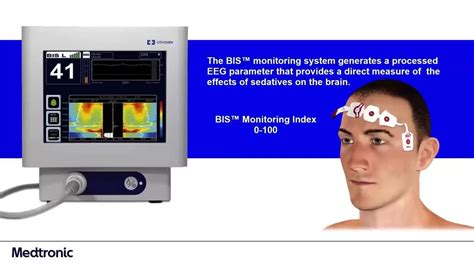 Medtronic Bispectral Index Bis Complete 2 Channel Monitoring System
