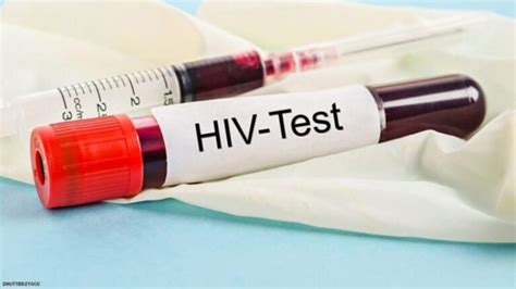 All You Need To Know About Hiv Testing Demotix