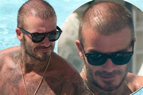 Obviously, this has captured the attention of so many men and likely women. David Beckham Going Bald