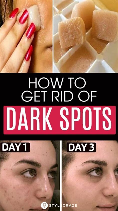 6 Home Remedies To Remove Dark Spots On The Face Dark Spots On Skin