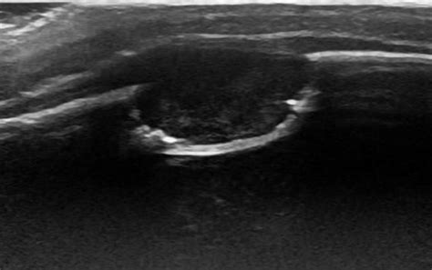 November 2016 Ultrasound Cases