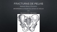 fracturas de pelvis clasificacion y diagnóstico | Pelvis | Lesión | uDocz