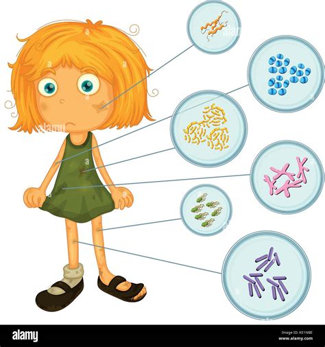 Ni A Sucia Con Bacterias En La Ilustraci N Del Cuerpo Imagen Vector De