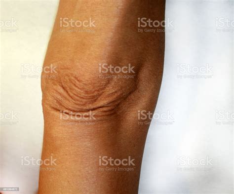 Wrinkles And Creases On His Elbow Old Wrinkled Elbow Stock Photo