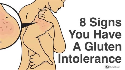 8 Signs You Have A Gluten Intolerance