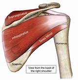 The clavicle (collarbone), the scapula (shoulder blade), and the humerus (upper arm bone) as well as associated muscles, ligaments and tendons. Diagram Of Shoulder Muscles And Tendons - Shoulder Impingement Tendonitis Pinnacle Orthopaedics ...