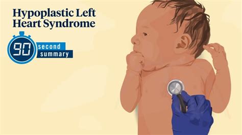 Quick Summary Hypoplastic Left Heart Syndrome Hlhs