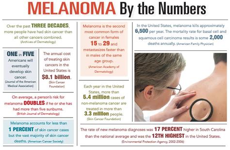 Skin Cancer A Growing Health Risk In The United States Charleston