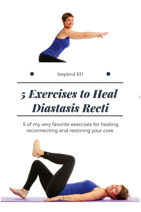 Diastasis Recti 5 Healing Exercises From The Creator Of Mutu System
