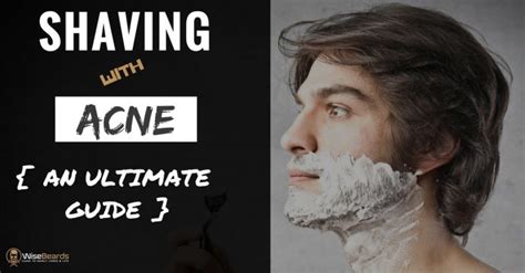 How To Shave With Acne And Sensitive Skin Complete Guide Tips