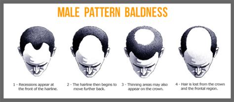 Male Pattern Baldness Fabrickated
