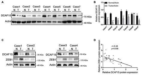 tumor suppressor dcaf15 inhibits epithelial mesenchymal transition by targeting zeb1 for