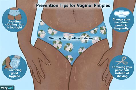 Vaginal Pimples Why They Form And What To Do Meopari