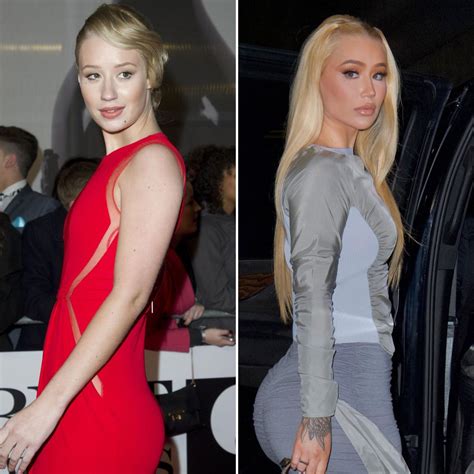 Iggy Azalea Has Been Honest About Plastic Surgery See Her Before And After Transformation Photos