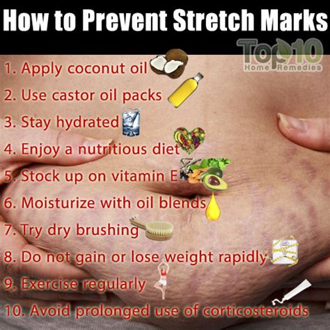 How To Prevent Stretch Marks Top 10 Home Remedies