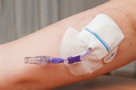 Picc Line Stock Photos Pictures And Royalty Free Images Istock