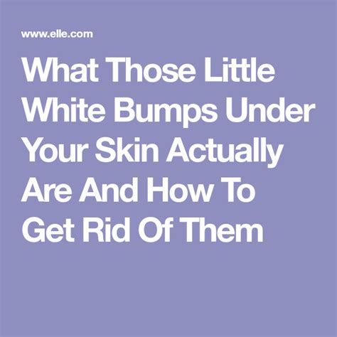 What Those Little White Bumps Under Your Skin Actually Are And How To