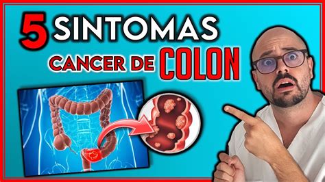 5 SÍntomas Que Pueden Indicar Un CÁncer De Colon ¡no Ignores Estos SÍntomas Youtube