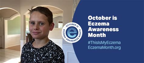 October Is Eczema Awareness Month National Eczema Association