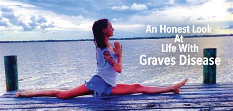 An Honest Look At Life With Graves Disease Diet Graves