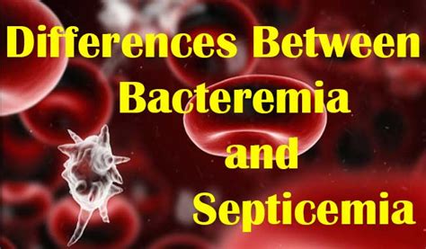 They also sound the same and thus are difficult to differentiate. Differences Between Bacteremia and Septicemia