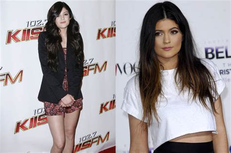Kardashians Star Kylie Jenner Slams Insulting Plastic Surgery Rumours