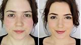 Skincare And Makeup For Rosacea Photos