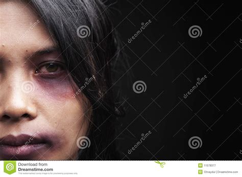 Domestic Violence Victim Royalty Free Stock Photography