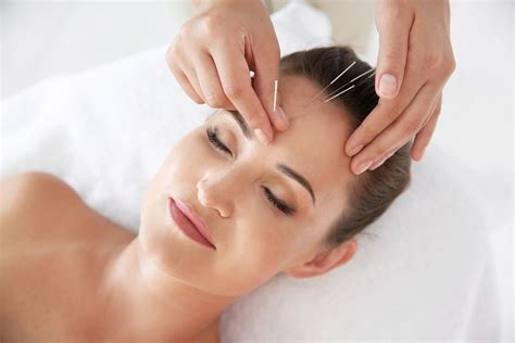 5 Best Acupuncture Specialists In Melbourne Top Acupuncture Specialists