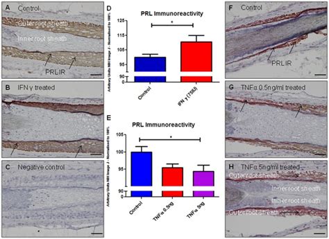 A Prl Ir In Control Hair Follicle Outer Root Sheath Keratinocytes