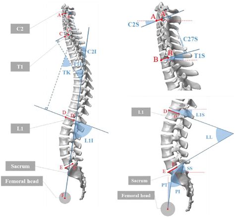 Representative Parameters Of Spinal Sagittal Alignment Download