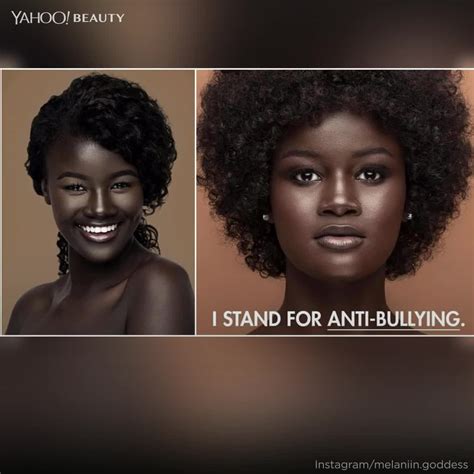 Model Bullied For Her Dark Skin Stars In Empowering New Campaign Video