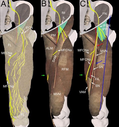 Anterior Femoral Cutaneous Nerve Pain