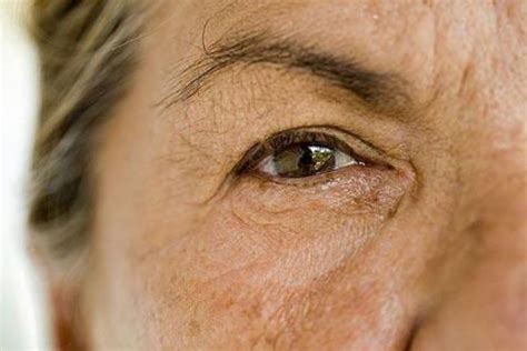 Eye Care Tips For People With Alzheimers And Dementia The Eye News