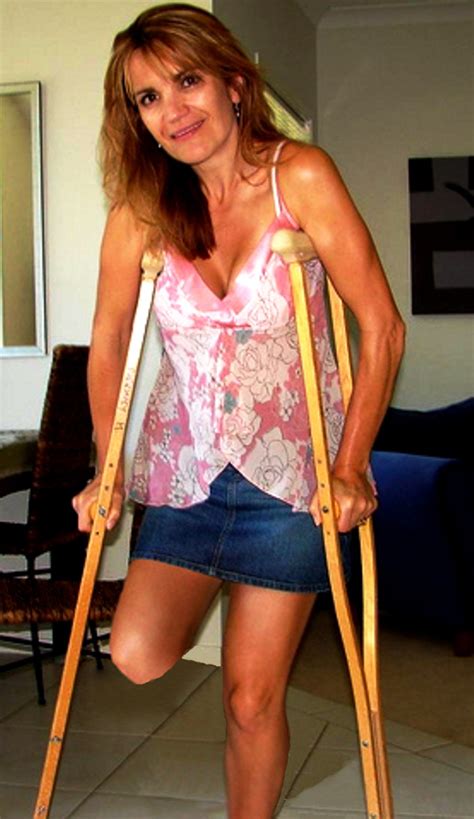 Sak Amputee Women With Wooden Crutches 3 Flickr