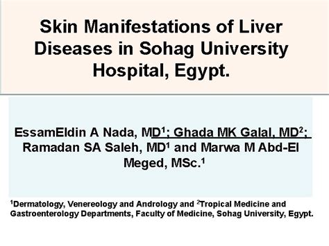 Skin Manifestations Of Liver Diseases In Sohag University