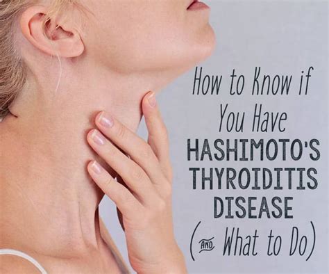 Hashimotos Disease Is A Form Of Thyroid Disease With Rapidly Rising