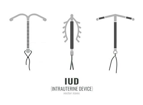 Copper Iud Late Period 4 Extraordinary Causes