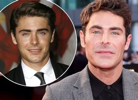 Zac Efrons Plastic Surgery His Explanation For Why His Appearance Has