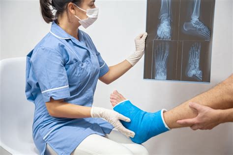 Foot And Ankle Fracture Specialist Sprained Ankle Treatment
