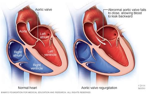 St Elizabeth Healthcare Procedure