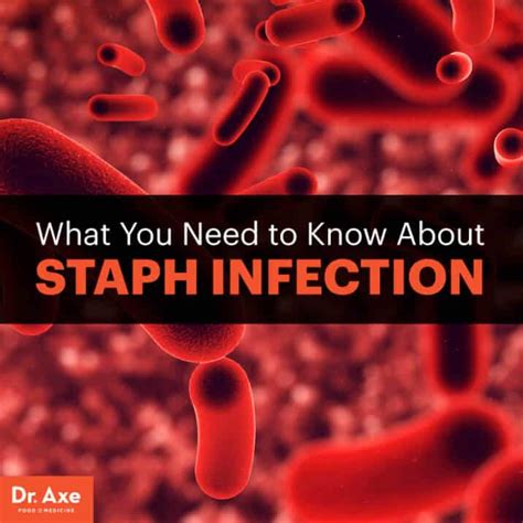 Staph Infection Symptoms Causes And Natural Treatments Dr Axe