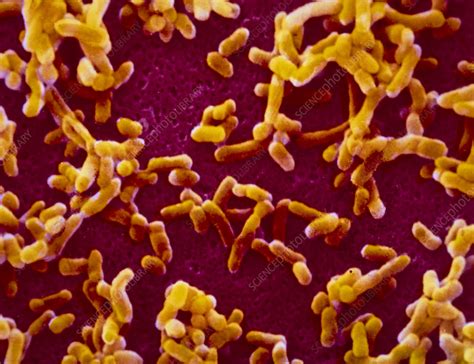 Bubonic plague is the most common form and is characterized by painful swollen lymph nodes or 'buboes'. Yersinia pestis (plague) bacteria - Stock Image - B220 ...