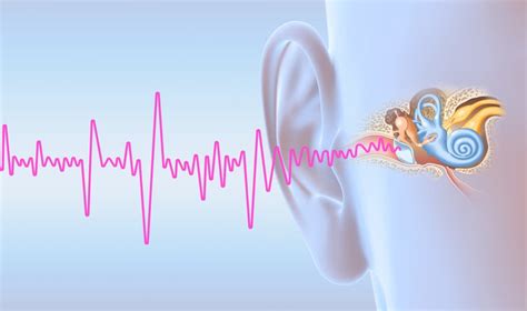 Everything You Need To Know About Pulsatile Tinnitus Viral Rang